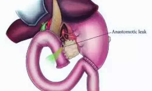 Early Detection and Timely Management of Anastomotic Leak Improves Survival After Colon Resection: JAMA