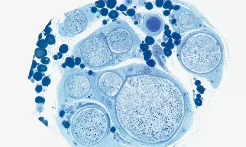 Angiotensin II–Stimulating vs Inhibiting BP Drugs: Stimulating Class Linked to Lower Dementia Pathology Risk, JAMA