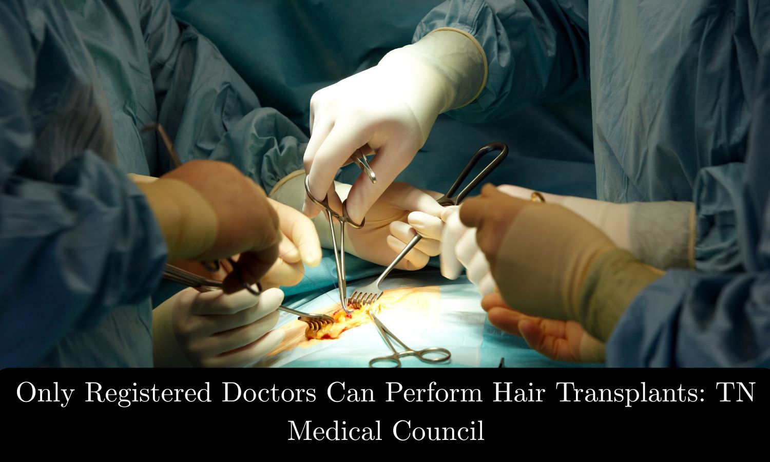 Only Registered Doctors Can Perform Hair Transplants, Aesthetic Procedures: TN Medical Council