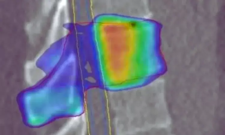 Rare Double-Site Intussusception With Volvulus Reported in a Healthy 26-Year-Old: Case Report Rare Double-Site Intussusception With Volvulus Reported in a Healthy 26-Year-Old: Case Report
