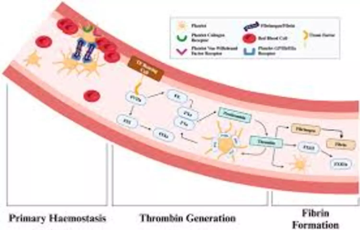 Elevated Carboxyterminal Propeptide of Fibrinogen accurate diagnostic Marker in Acute Appendicitis: Study Elevated Carboxyterminal Propeptide of Fibrinogen accurate diagnostic Marker in Acute Appendicitis: Study