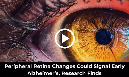 Peripheral Retina Changes Could Signal Early Alzheimers, Research Finds