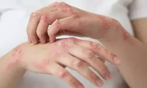 Uttarakhand Declares Leprosy a Notifiable Disease to Strengthen Surveillance and Prevent Transmission.