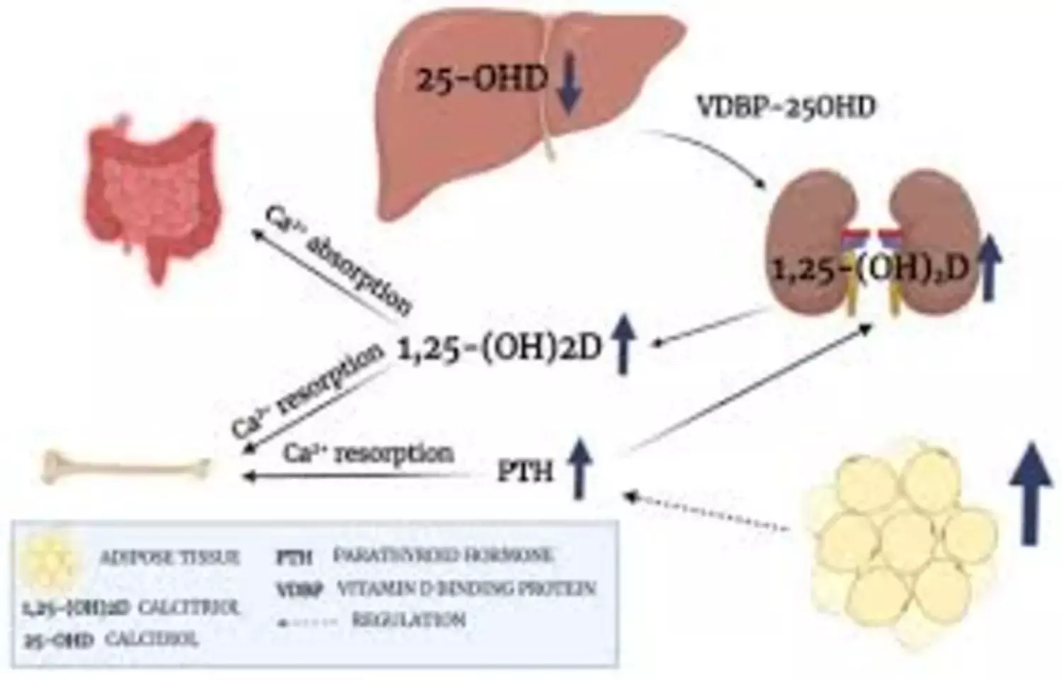 Preoperative Vitamin D May Reduce Hypocalcemia After Parathyroidectomy, suggests study Preoperative Vitamin D May Reduce Hypocalcemia After Parathyroidectomy, suggests study