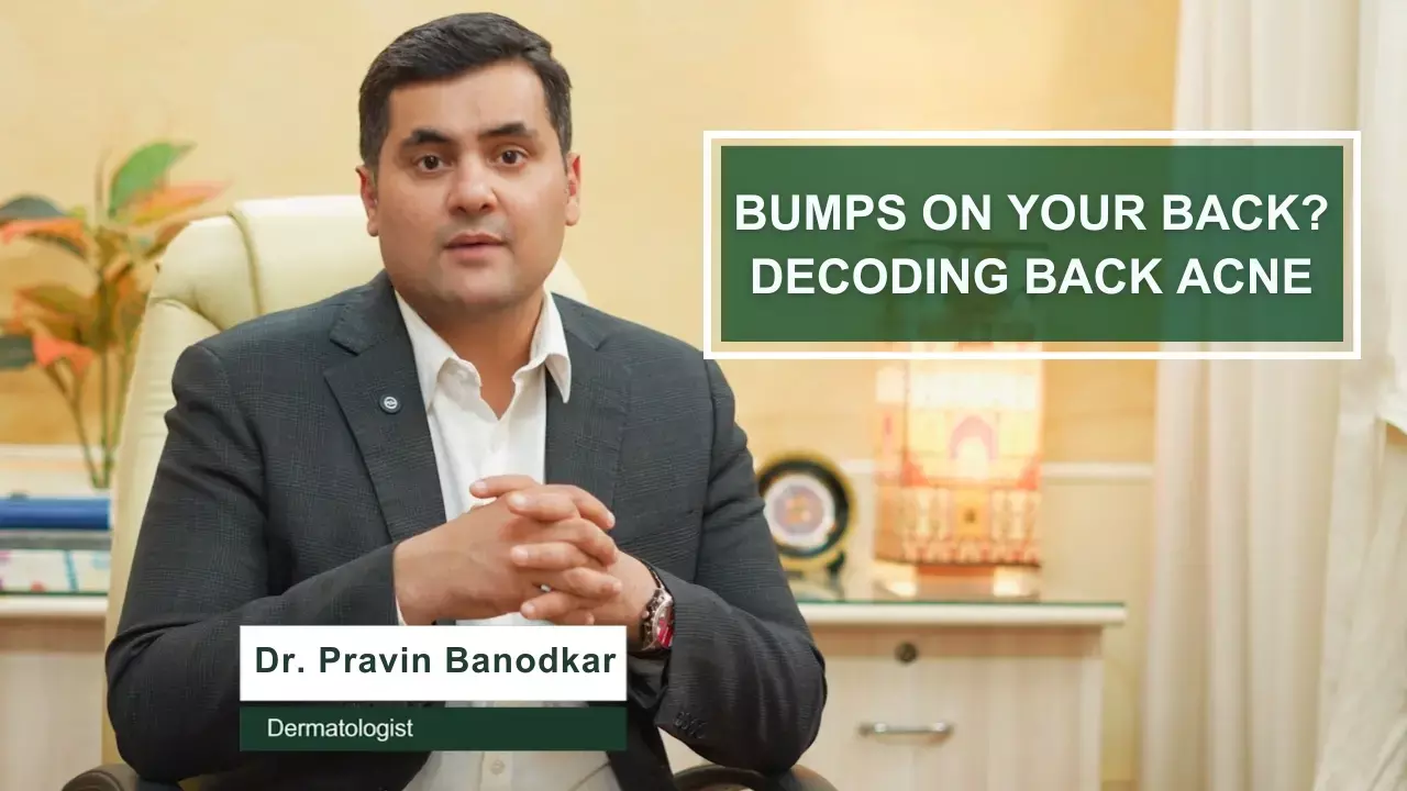 Decoding Back acne with Dermatologist Dr Pravin Banodkar
