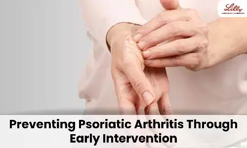 From Psoriasis to Psoriatic Arthritis: Strategies for Early Risk Modification