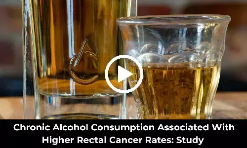 Chronic Alcohol Consumption Associated With Higher Rectal Cancer Rates: Study