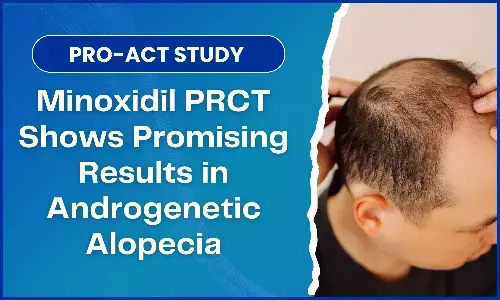 PRO-ACT Study Shows Better Outcomes with Minoxidil PRCT for Androgenetic Alopecia