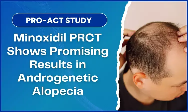 PRO-ACT Study Shows Better Outcomes with Minoxidil PRCT for Androgenetic Alopecia