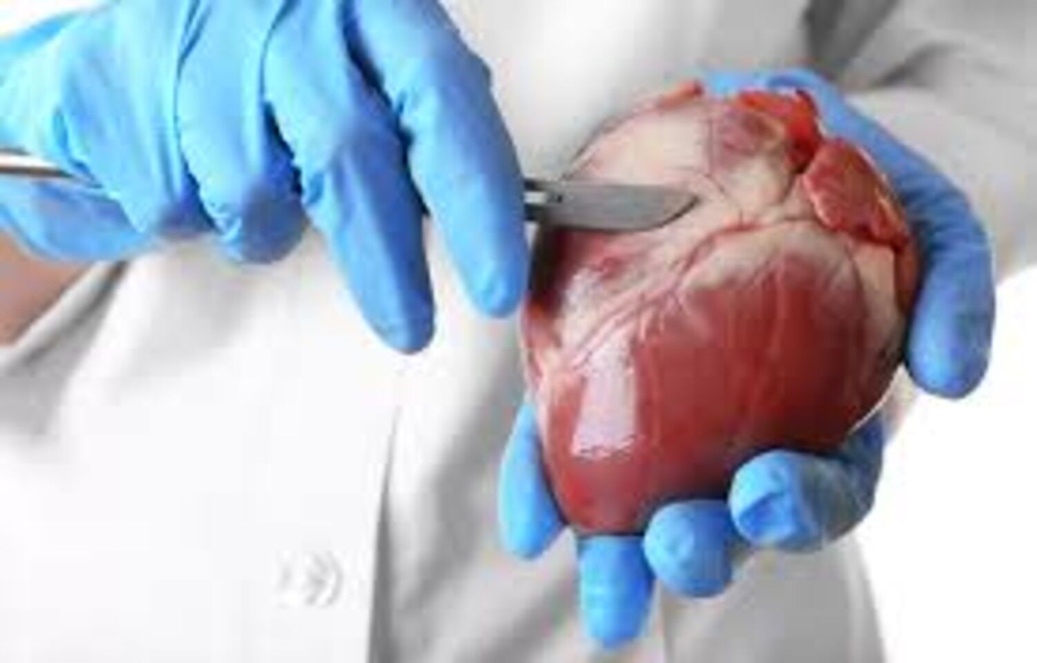 Canagliflozin Shows Promise for Heart Failure After Cardiac Surgery: Study