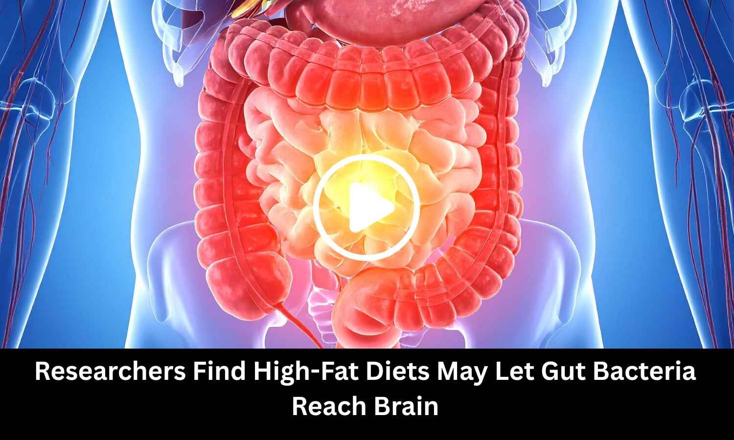 Researchers Find High-Fat Diets May Let Gut Bacteria Reach Brain