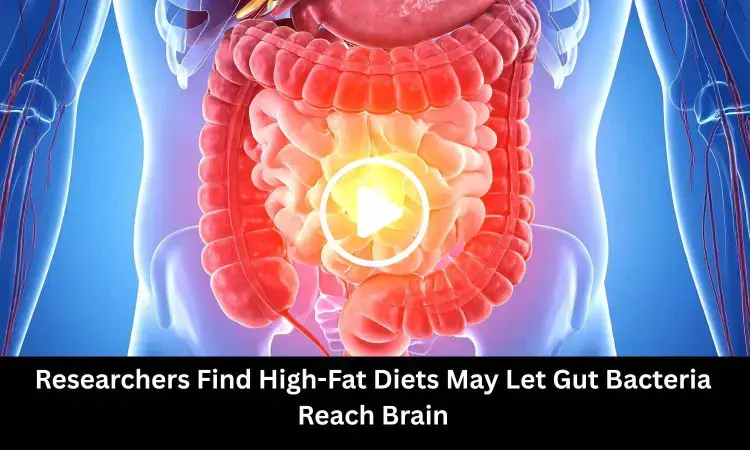 Researchers Find High-Fat Diets May Let Gut Bacteria Reach Brain