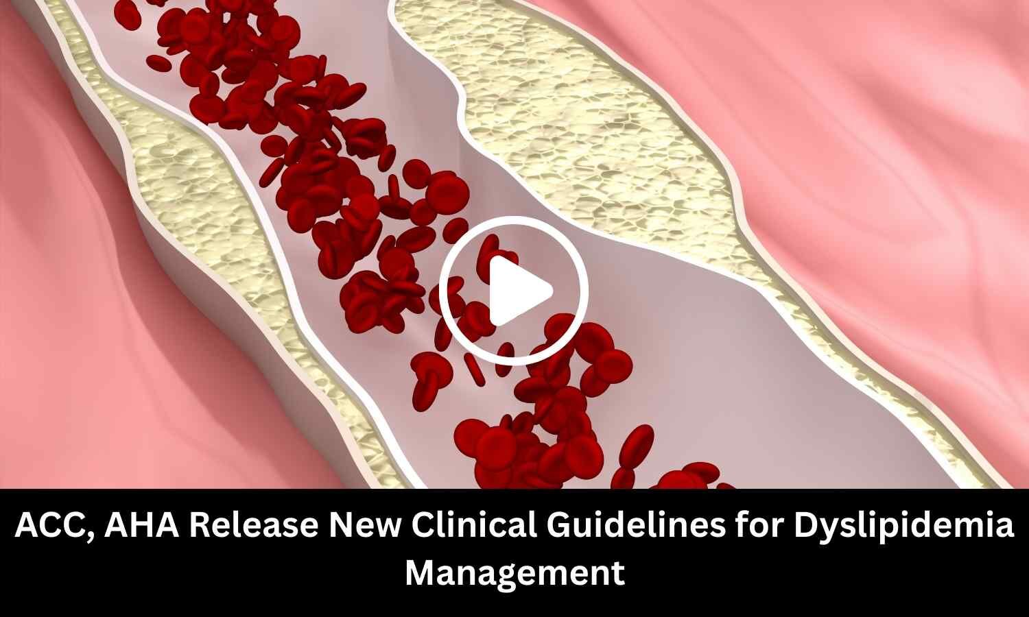 ACC, AHA Release New Clinical Guidelines for Dyslipidemia Management