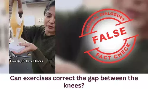 Fact Check: Can exercises correct the gap between the knees?