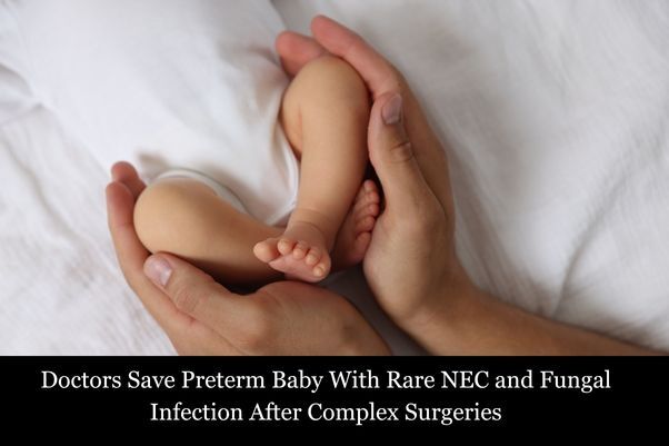 Doctors Save 33-Week Preterm Baby With Rare NEC, Fungal Infection After Complex Surgeries