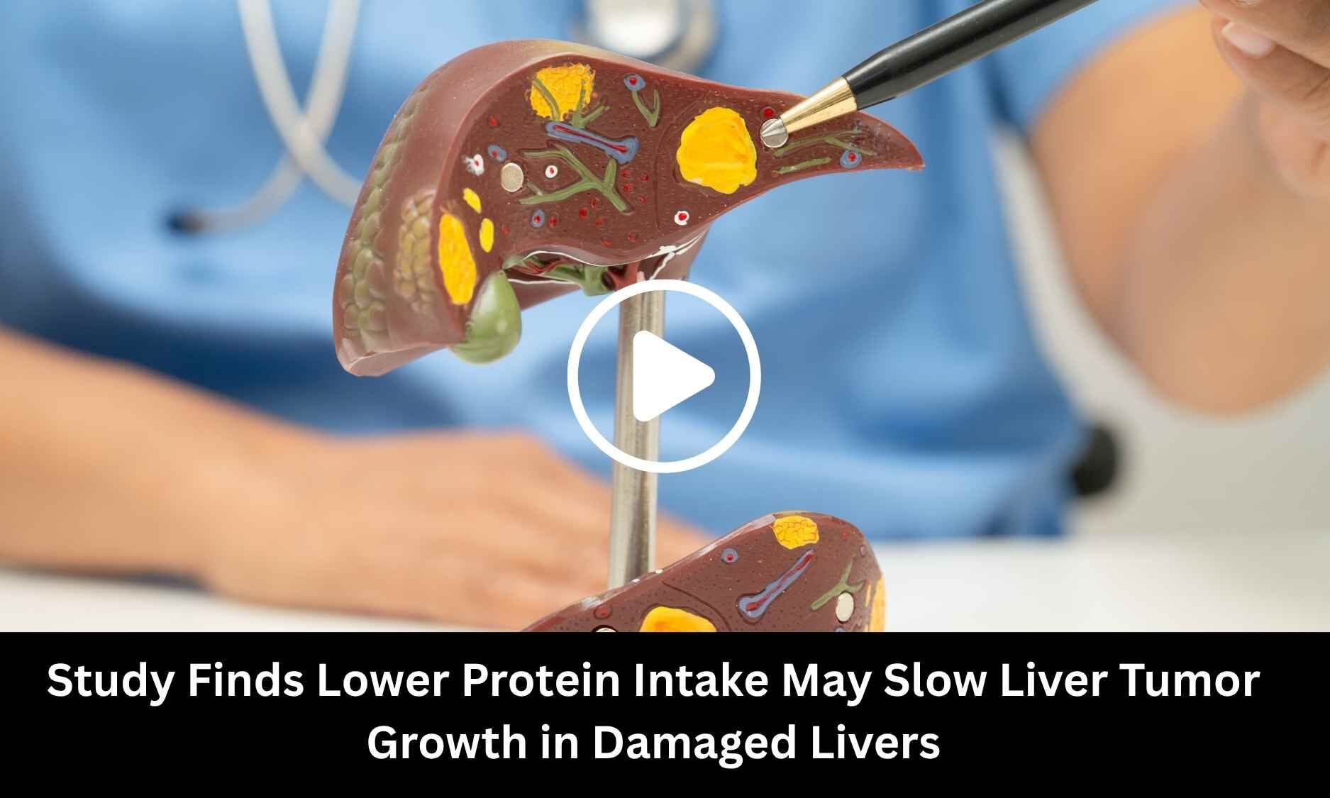 Study Finds Lower Protein Intake May Slow Liver Tumor Growth in Damaged Livers