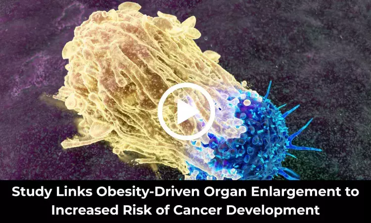 New Study Reveals How Obesity Drives Cancer Risk by Increasing Cell Numbers