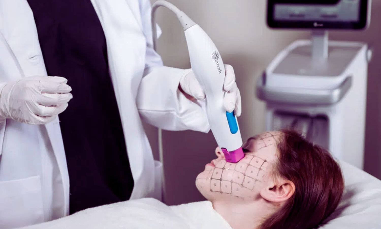 Thermage FLX Proven Effective and Safe for Skin Tightening, Shows Asia-Pacific Survey