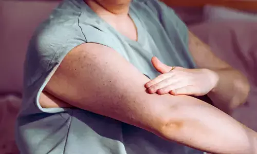 GLP-1 Agonists Improve Outcomes in Psoriatic Arthritis with Obesity: Study