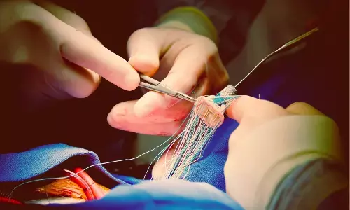 Early Surgery Improves Long-Term Outcomes in Asymptomatic Severe Aortic Stenosis: NEJM