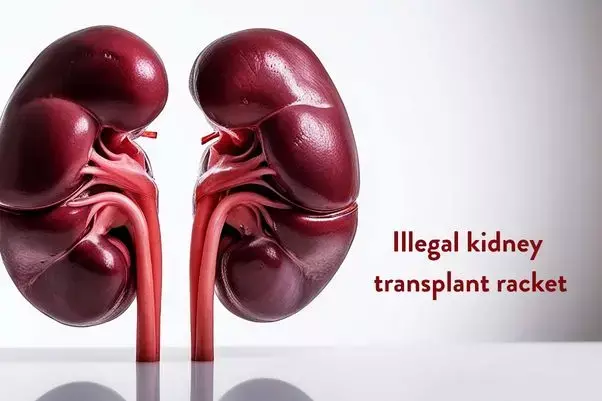 Kanpur Kidney Transplant Racket: Lookout notices issued for four doctors as probe expands
