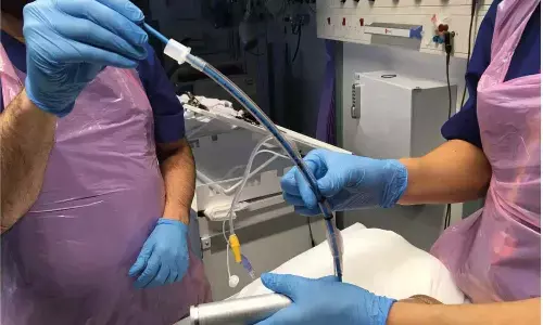 Study Suggests New Nomogram Accurately Predicts Nosebleed Risk After Nasotracheal Intubation Study Suggests New Nomogram Accurately Predicts Nosebleed Risk After Nasotracheal Intubation