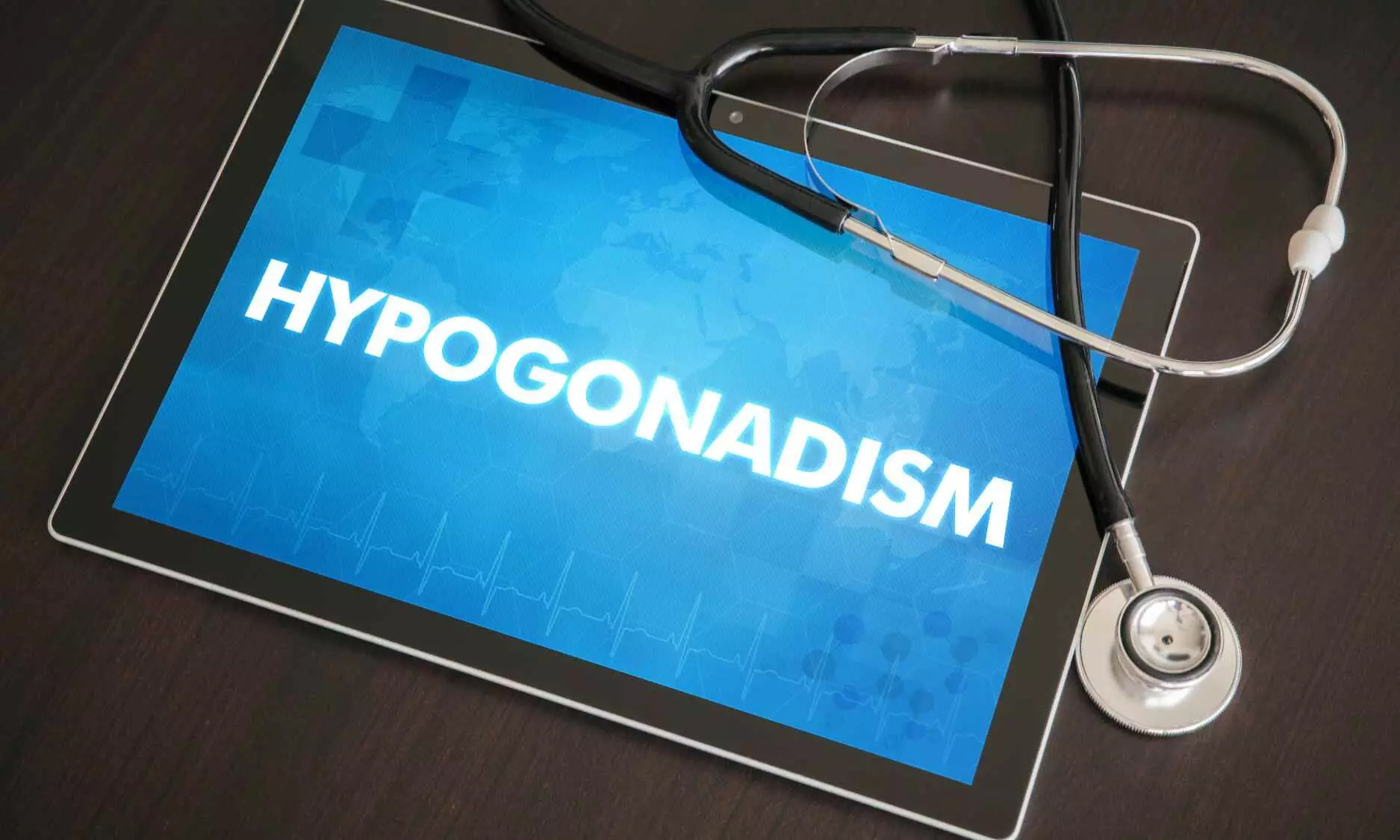 Early-Onset Hypogonadism in Adolescents Linked to Early Vascular Aging: Study