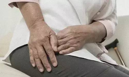 Early surgery within 24 hours in Patients with Hip Fracture on DOAC safe and beneficial: study