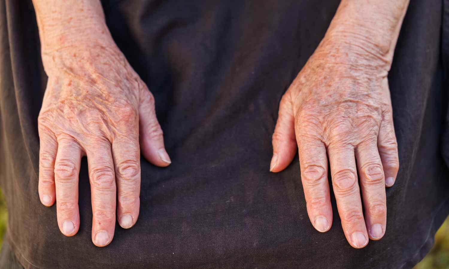 PEPITEM ‘replacement therapy’ shows potential for early-stage ...