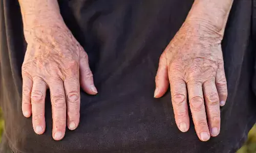 PEPITEM replacement therapy shows potential for early-stage inflammatory arthritis, suggests study