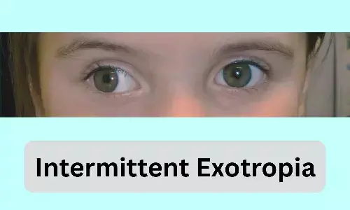 Luminopia Shows Promise as First Non-Surgical Treatment for Intermittent Exotropia