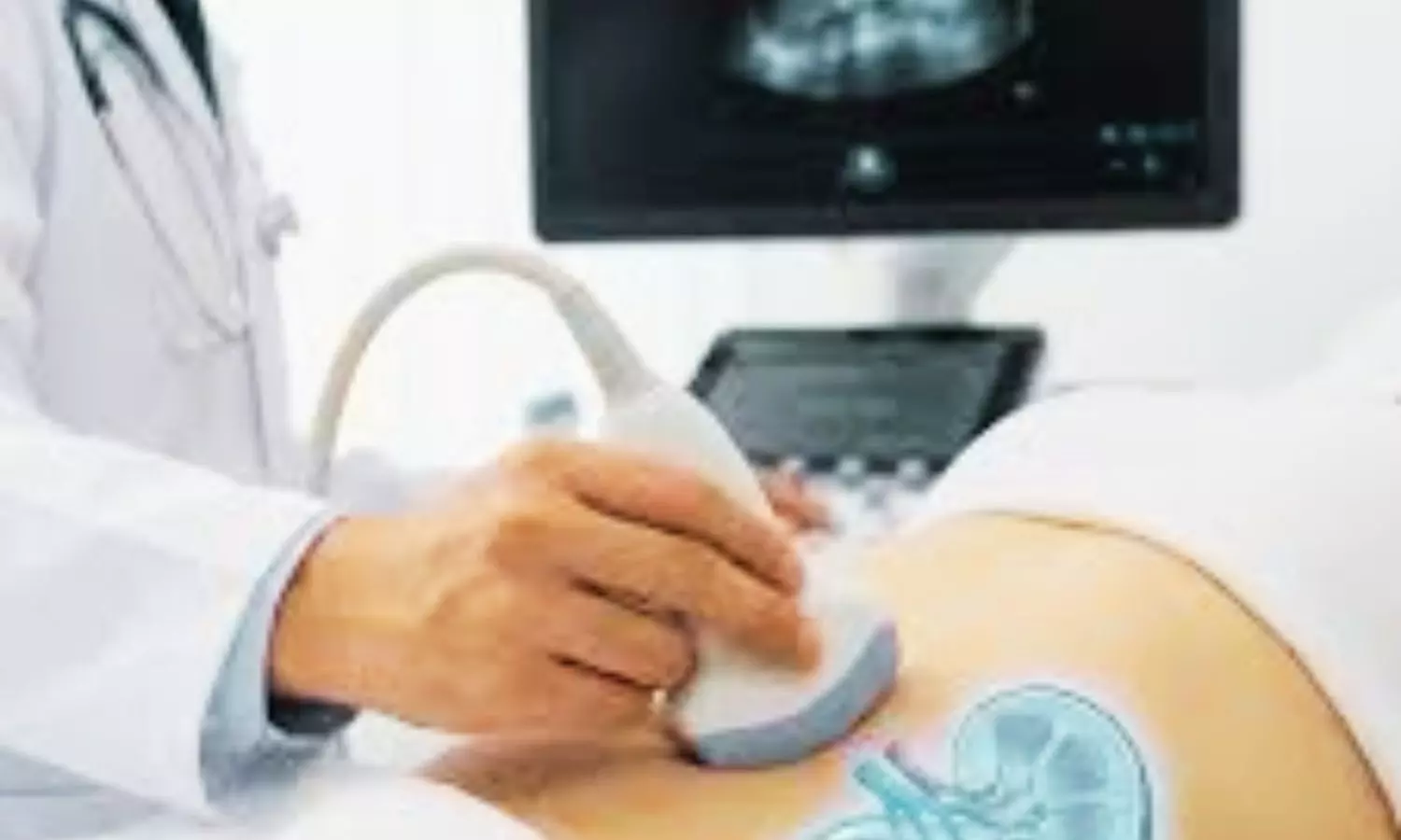 Renal POCUS may Detect Hydronephrosis, Predict Nephrolithiasis, Study Finds Renal POCUS may Detect Hydronephrosis, Predict Nephrolithiasis, Study Finds