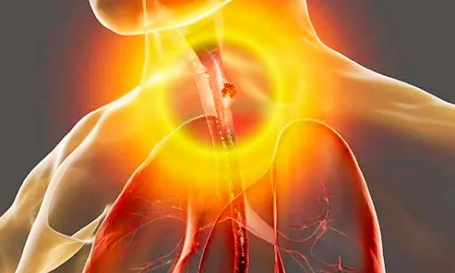 Very Hot Beverages Linked to Higher Esophageal Cancer Risk: Study