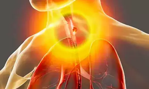 ICI Therapy Shows Durable Responses in dMMR Gastroesophageal Adenocarcinoma: JAMA