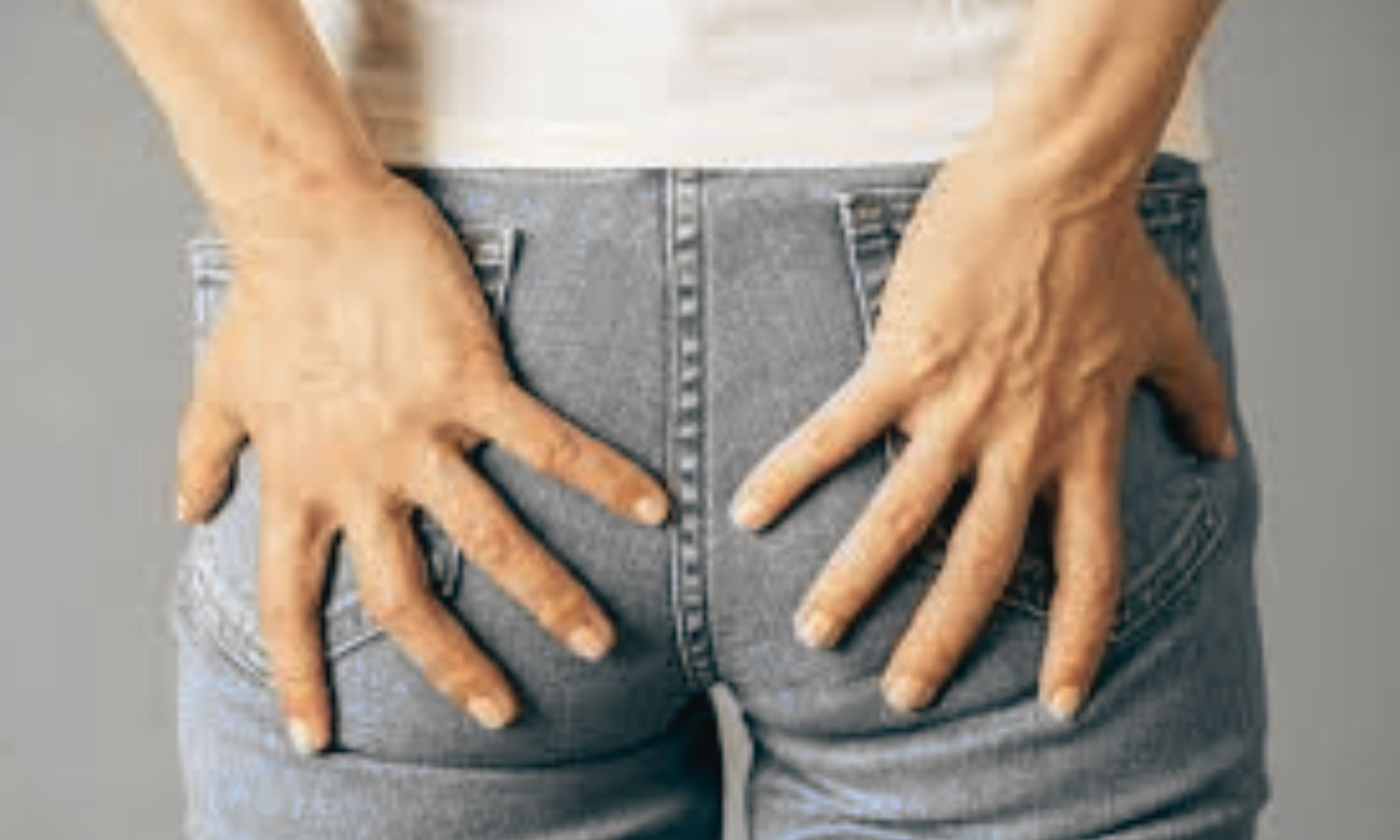 Add on Lateral Internal Sphincterotomy to Haemorrhoidectomy Reduces Post Op Pain, Improves Recovery: Study