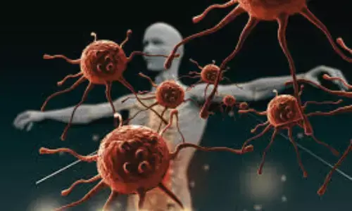 Obesity Increases Risk of Psoriasis and Autoimmune Diseases, Suggests Research