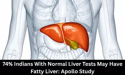 74% Indians With Normal Reports May Have Fatty Liver: Apollo Study