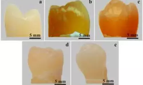 Use of Bromelain Toothpastes linked to Effective Stain Removal Without Enamel Damage: Study