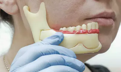 Digital jaw motion tracking may enhance Occlusal and TMJ Assessment, finds research