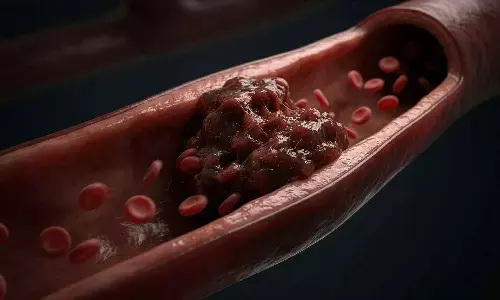 Circadian Protein Linked to Vascular Calcification in Diabetes, finds study