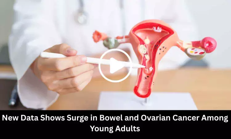New Data Shows Surge in Bowel and Ovarian Cancer Among Young Adults