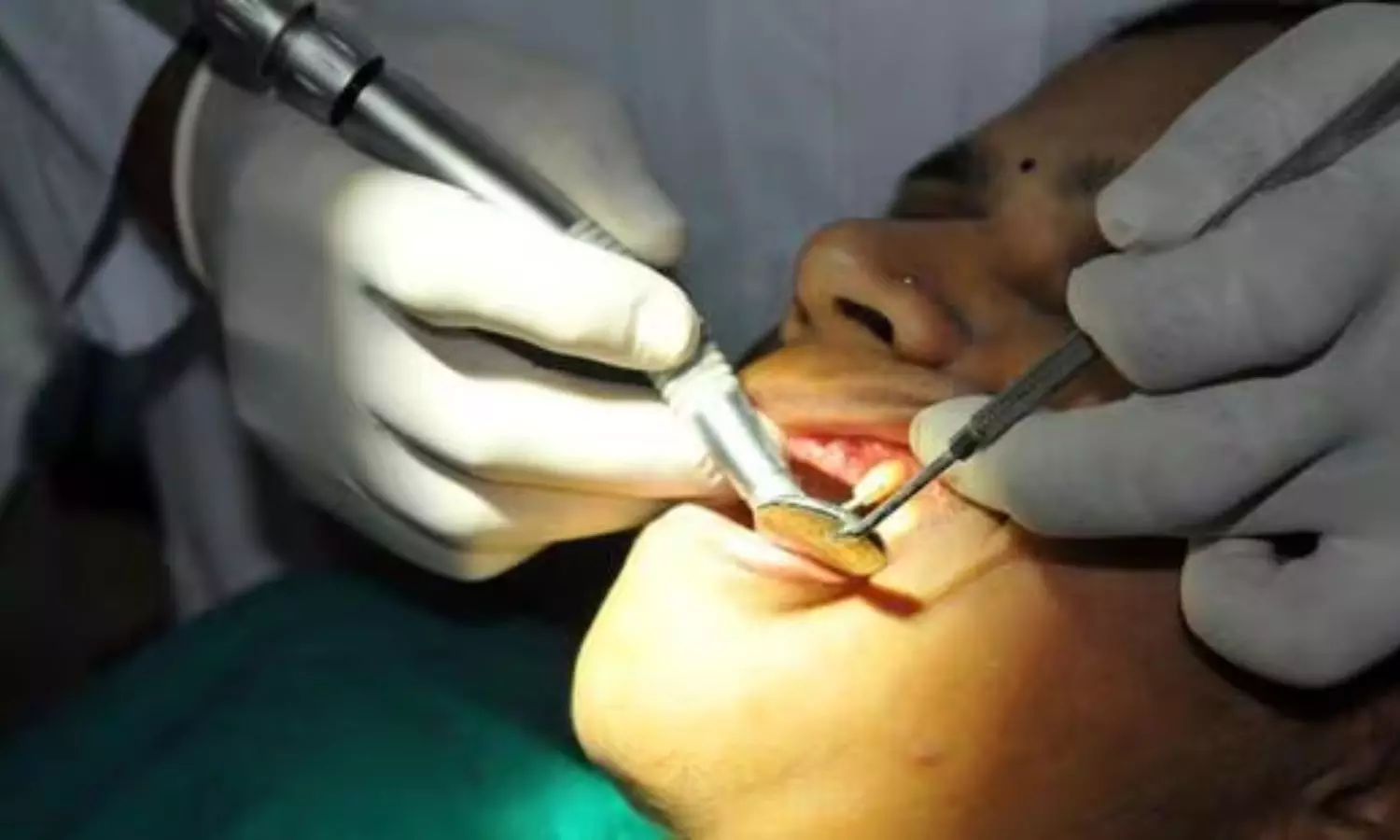 Jharkhands First Government MDS Programme to Begin at RIMS Dental Institute.