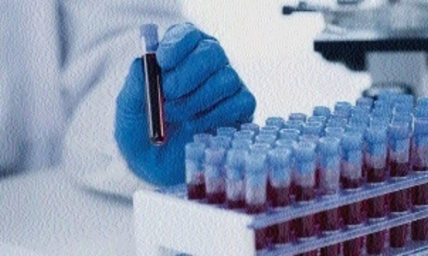 NSCB Medical College Proposes NAT Facility in Jabalpur to Enhance Blood Safety for Thalassemia Patients.