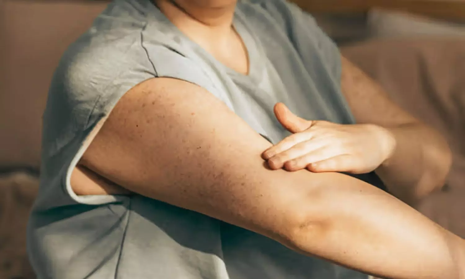 Combined Tirzepatide and Ixekizumab Therapy Shows Dual Benefits in Psoriasis: JAMA