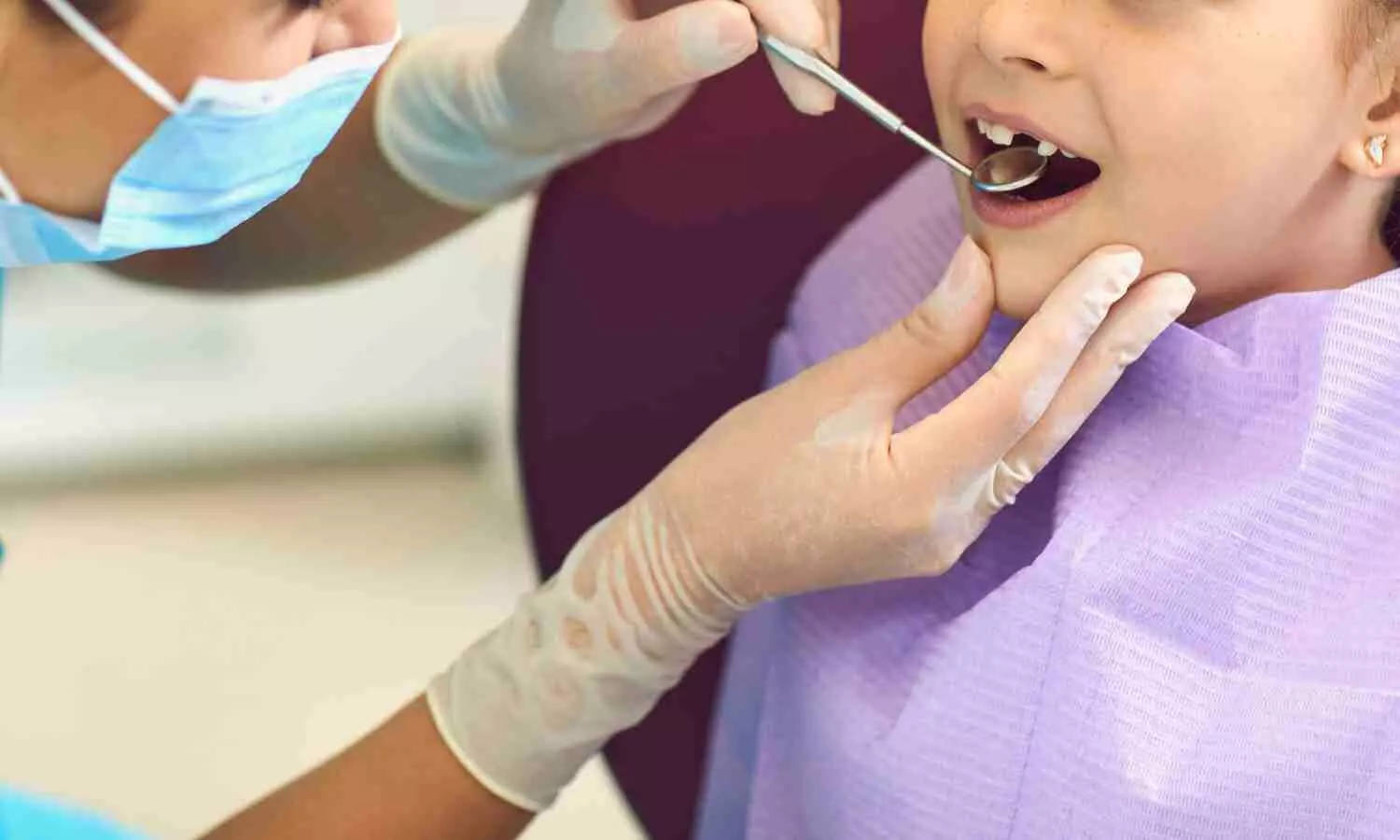 Intensive fluoride Varnish application has no impact on Oral Microbiome in kids with untreated ECC: Study