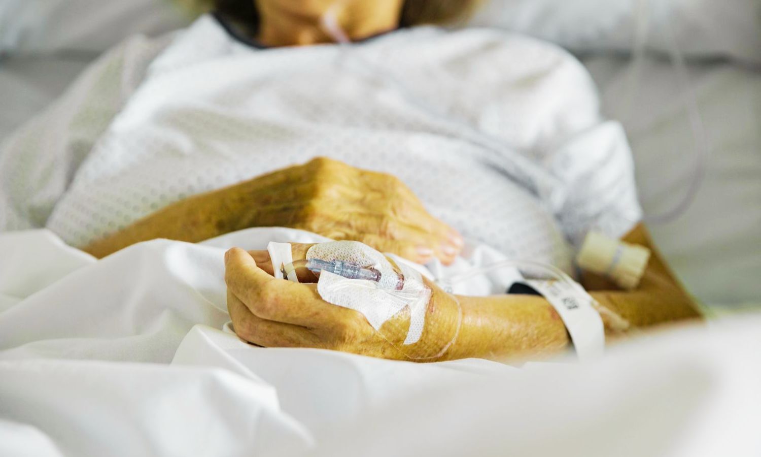 Semaglutide Initiation Linked to Life-Threatening Lactic Acidosis in an Elderly Patient: Case Report Semaglutide Initiation Linked to Life-Threatening Lactic Acidosis in an Elderly Patient: Case Report