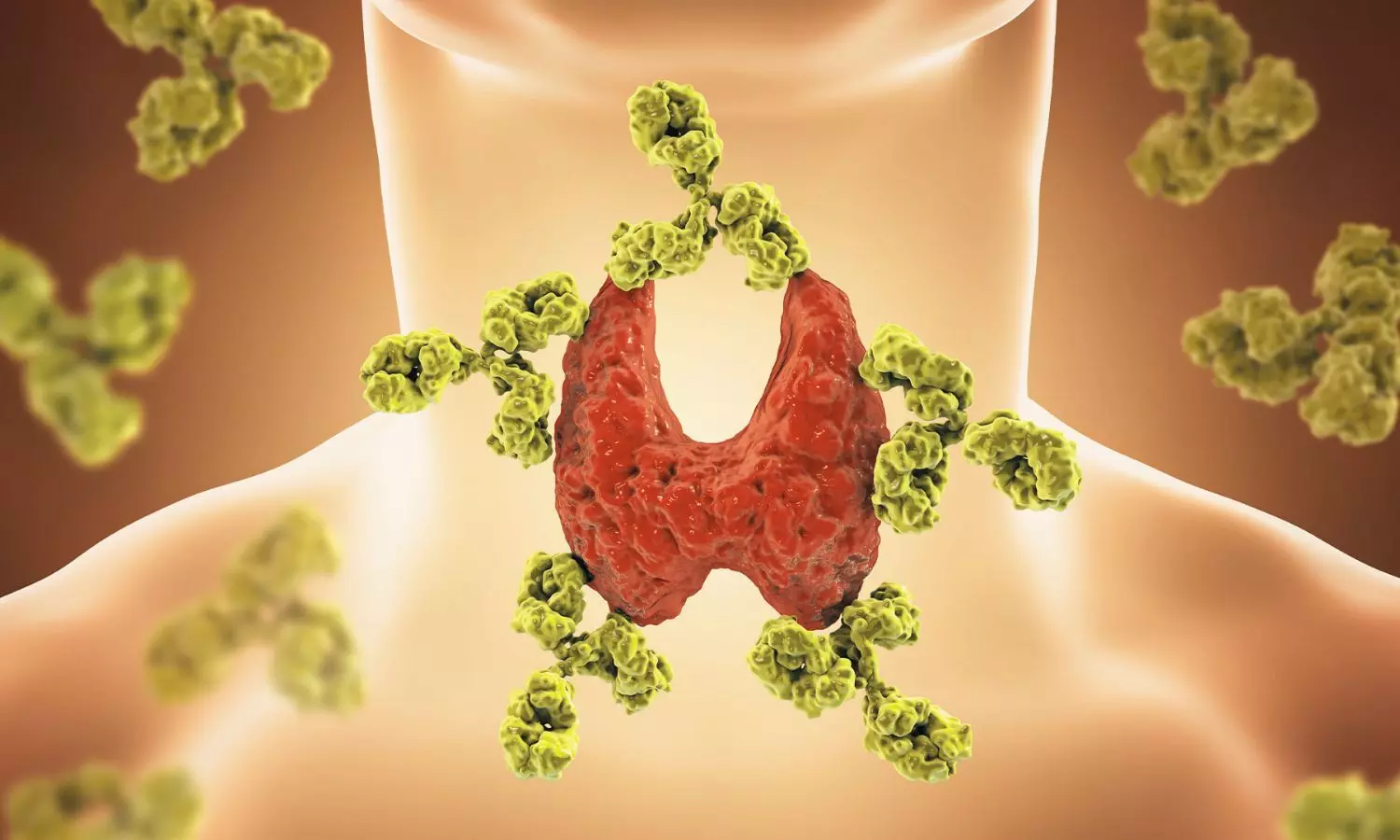 Combination LT3/LT4 Therapy Linked to Higher Psychiatric Risk in Autoimmune Hypothyroidism: Study Combination LT3/LT4 Therapy Linked to Higher Psychiatric Risk in Autoimmune Hypothyroidism: Study