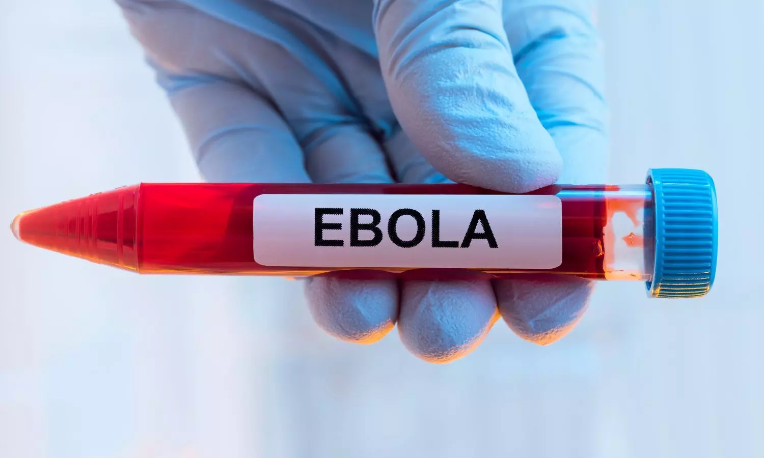 Amid Ebola outbreak in Africa, BMC MARD urges vigilance among Mumbai doctors Amid Ebola outbreak in Africa, BMC MARD urges vigilance among Mumbai doctors