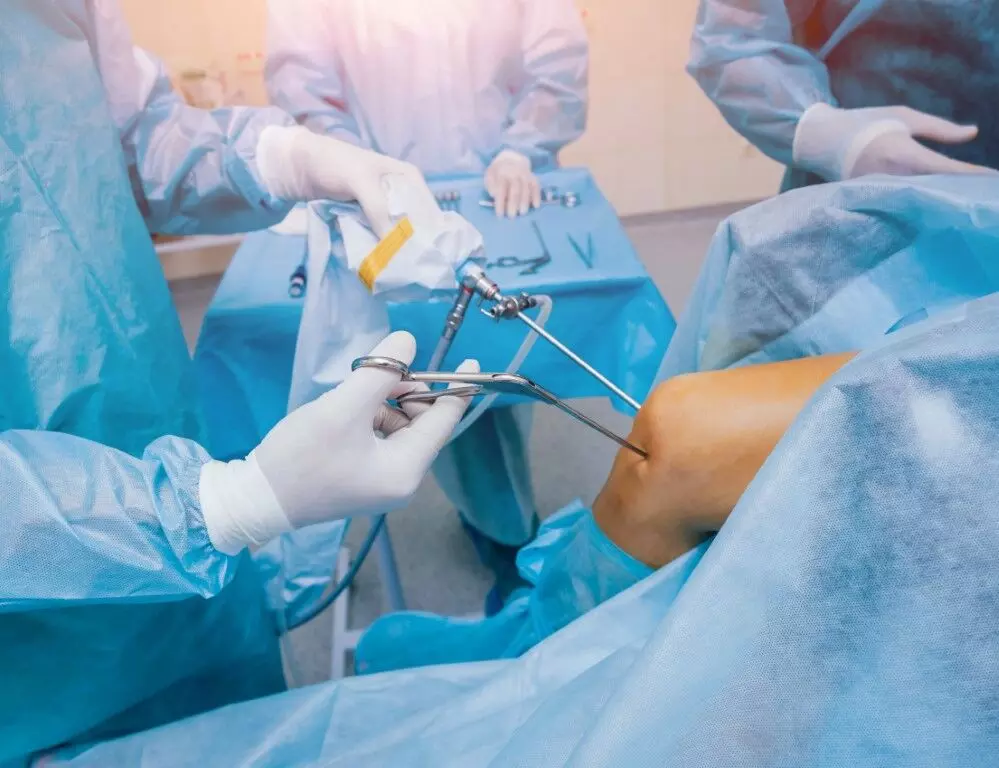 Peroneus Longus Tendon Emerges as Effective Alternative to Hamstring Grafts in ACL Reconstruction: Study