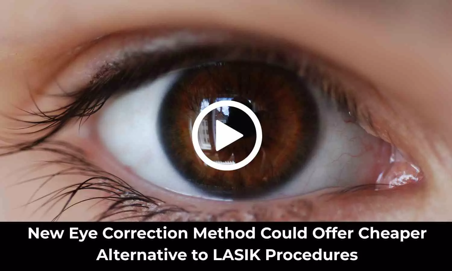 New Eye Correction Method Could Offer Cheaper Alternative to LASIK Procedures: Study Suggests